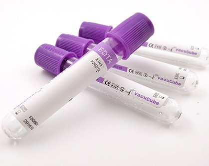 Трубка ЭТИЛЕНДИАМИНТЕТРАЦЕТАТА JINGZ 0.5ml-10ml K2 для вакуума анализа крови согласно высоте