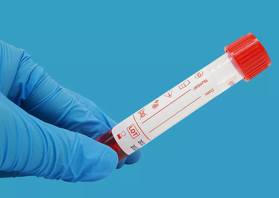Набор извлечения устранимого набора забора вируса 10ml нуклеиновый кисловочный